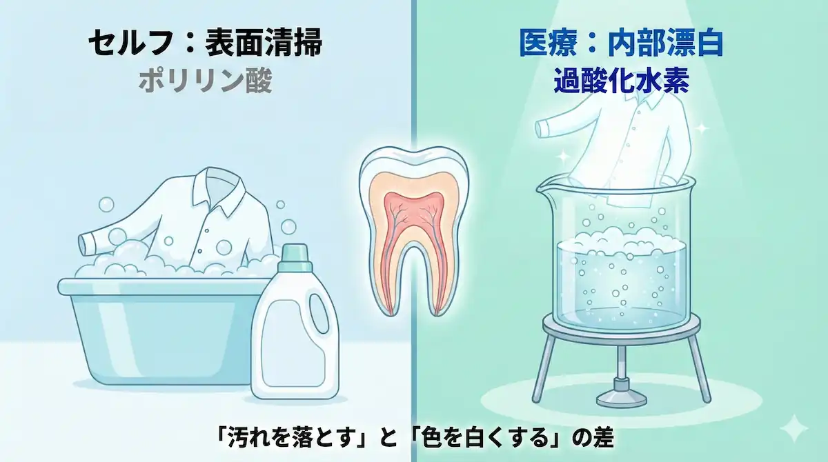 「シャツ洗濯」と「シャツの漂白」の比較 セルフホワイトニング(ポリリン酸)と医療ホワイトニング(過酸化水素)の成分と作用機序の比較図。表面の汚れを落とす「清掃」と、内部の色素を分解する「漂白」という対立関係を、洗濯とクリーニングの比喩を用いて説明している。