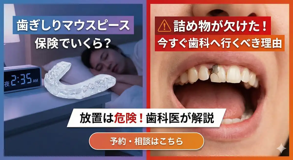 歯ぎしりマウスピースは保険でいくらか解説する記事のアイキャッチ画像